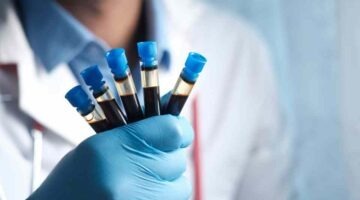 Book a blood test in Manchester